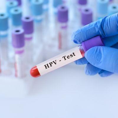 HPV DNA 28 + HSV I/II DNA