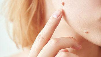 Dermatolog