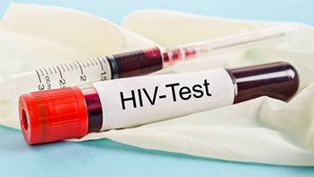 Test na HIV Ag/Ab (Combo)