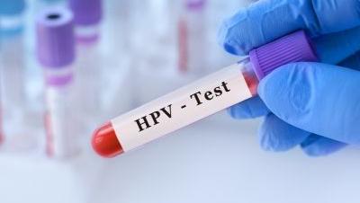 HPV-4  z genotypowaniem