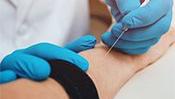 Elektromiografia (EMG) - próba tężyczkowa