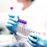 Fasciola hepatica (Liver Fluke) antibodies