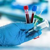 Test package - HIV prevention (PEP)