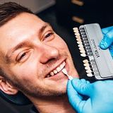 Teeth whitening - 2 arches