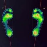Comprehensive assessment of posture, walk and feet with custom orthotic insoles