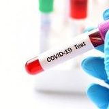 Przeciwciała po przechorowaniu SARS-CoV-2 całkowite ilościowo