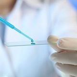 Liquid-based cytology (LBC) of the cervix with sampling at a medical centre