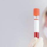 FibroTest, full test