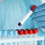 P.ciała przeciw kleszczowemu zapaleniu mózgu IgG