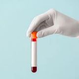 Tick-borne encephalitis (TBE) IgG antibodies