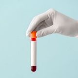 HIV - antygen/przeciwciała (do testu potwierdzenia)