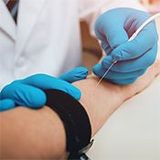 Elektromiografia (EMG) - próba tężyczkowa