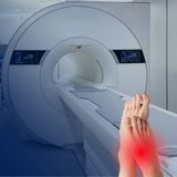 Rezonans magnetyczny stopy bez kontrastu