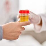 Creatinine in urine