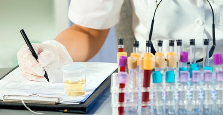 Leukocyty w moczu norma