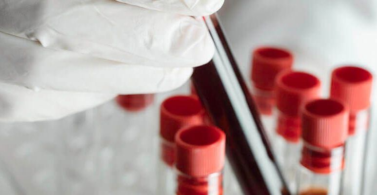 Dłoń w rękawiczkach trzyma probówkę z krwią