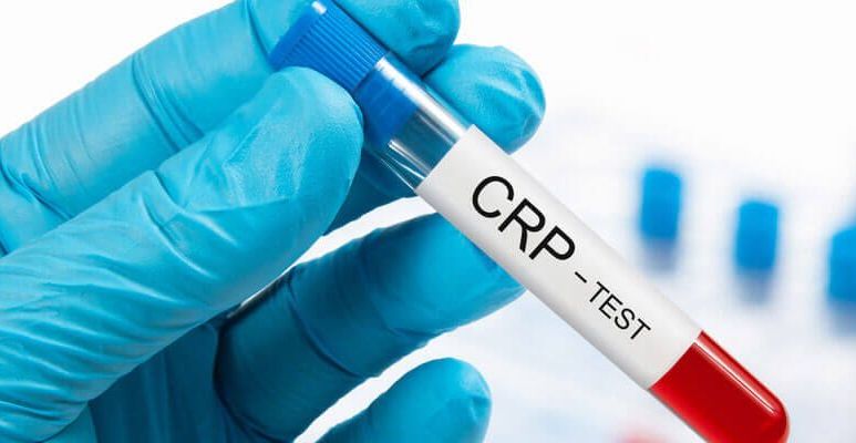 CRP - kiedy wykonujemy badanie białka ostrej fazy?
