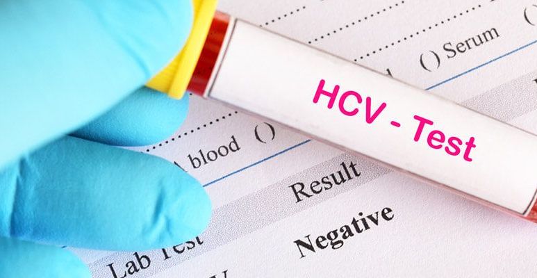 Wirus HCV – zakażenie, objawy WZW, diagnoza zapalenia wątroby typu C