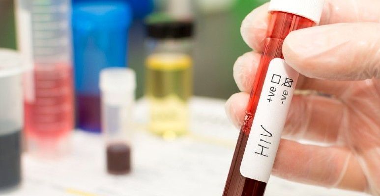 Zespół Downa to zespół wad wrodzonych, charakteryzujący się nieprawidłową liczbą 21 pary chromosomów. Ryzyko urodzenia dziecka z zespołem Downa wzrasta wraz z wiekiem matki.