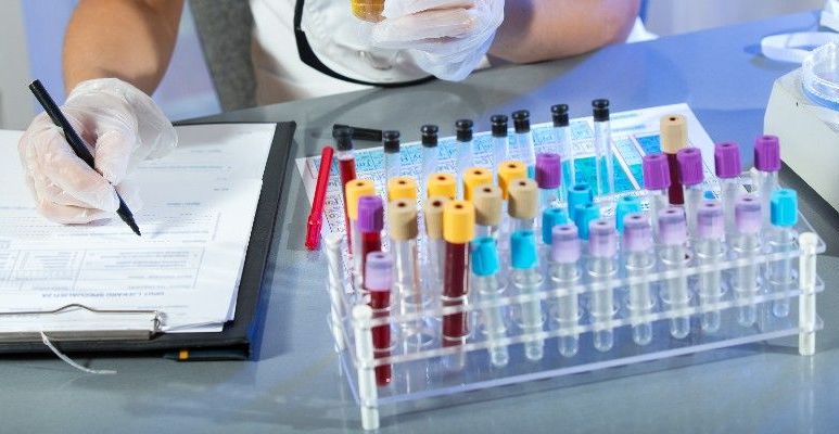 Morfologia krwi - na czym polega?