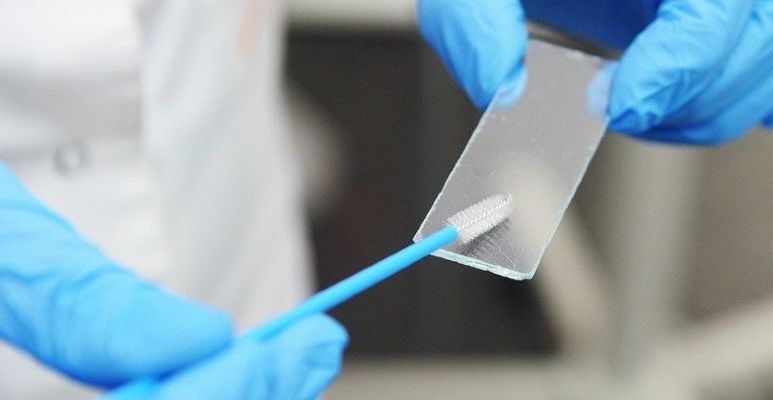 Próbka krwi do badania markerów nowotworowych na formularzu z wykazem badań na raka