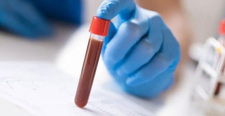 Dłoń w rękawiczce podtrzymuje próbówkę z krwią