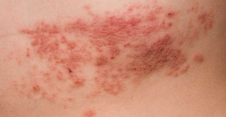 Choroby skóry i inne | MediStore