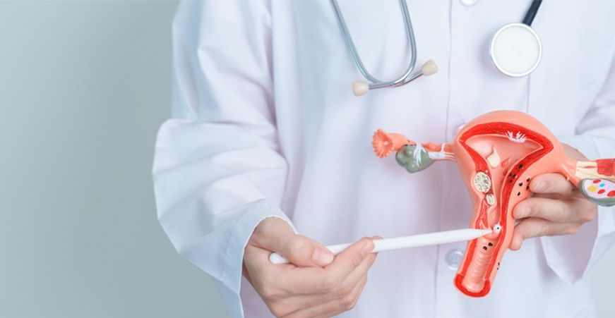 Rak szyjki macicy to nowotwór złośliwy. Badania przesiewowe umożliwiają wczesne wykrycie raka w obrębie szyjki macicy.