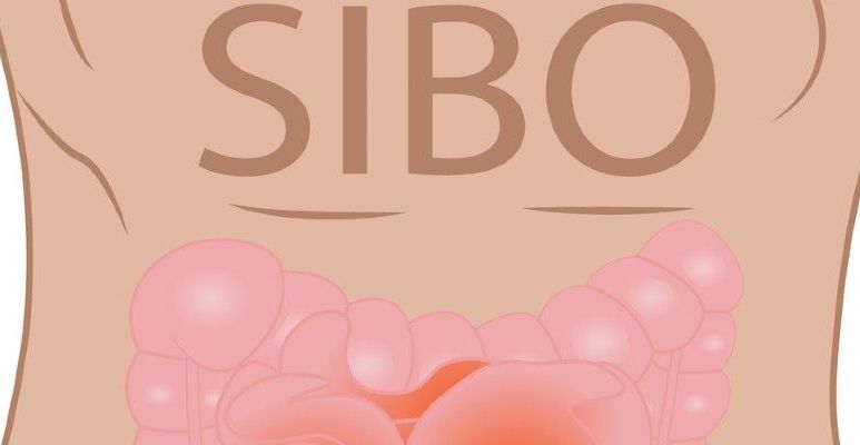 Rysunek brzucha z napisem SIBO i ilustracją jelit