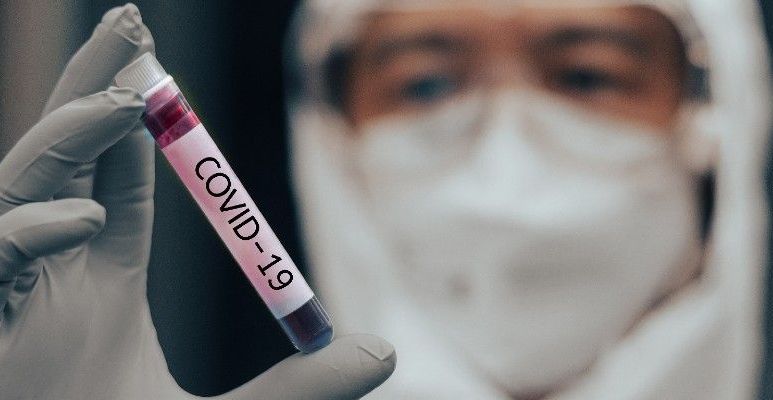 Test na koronawirusa SARS-COV-2, rodzaje badań na COVID-19, gdzie wykonać?