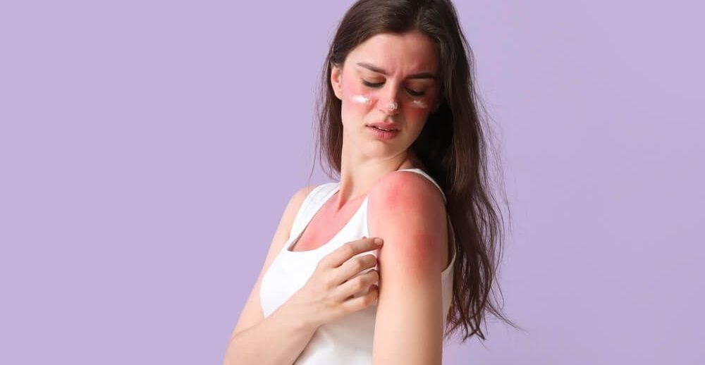 Uczulenie na słońce – czym jest? Uczulenie słoneczne to reakcja organizmu na działanie promieni słonecznych.