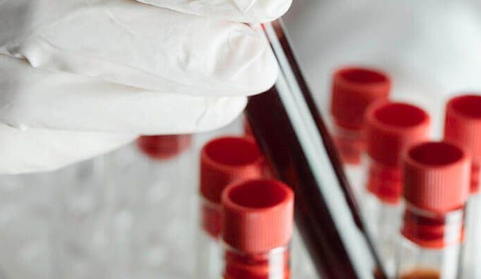 Dłoń w rękawiczkach trzyma probówkę z krwią