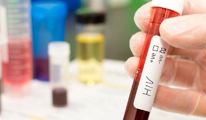 Zespół Downa to zespół wad wrodzonych, charakteryzujący się nieprawidłową liczbą 21 pary chromosomów. Ryzyko urodzenia dziecka z zespołem Downa wzrasta wraz z wiekiem matki.