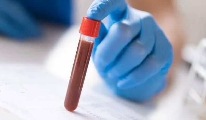 Dłoń w rękawiczce podtrzymuje próbówkę z krwią