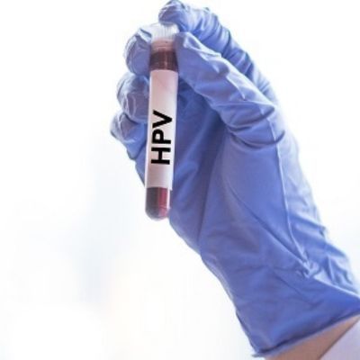 HPV DNA 6 i 11 (2 genotypy)