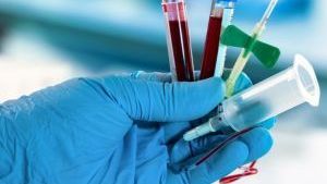 Pakiet badań - profilaktyka HIV (PEP)