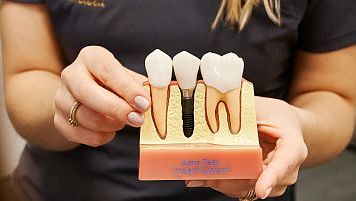 Implant consultation