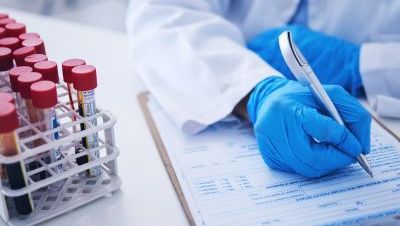 Badanie PSA całkowity