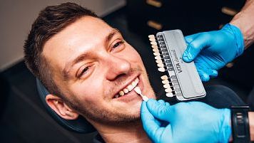 Wybielanie zębów - 2 łuki