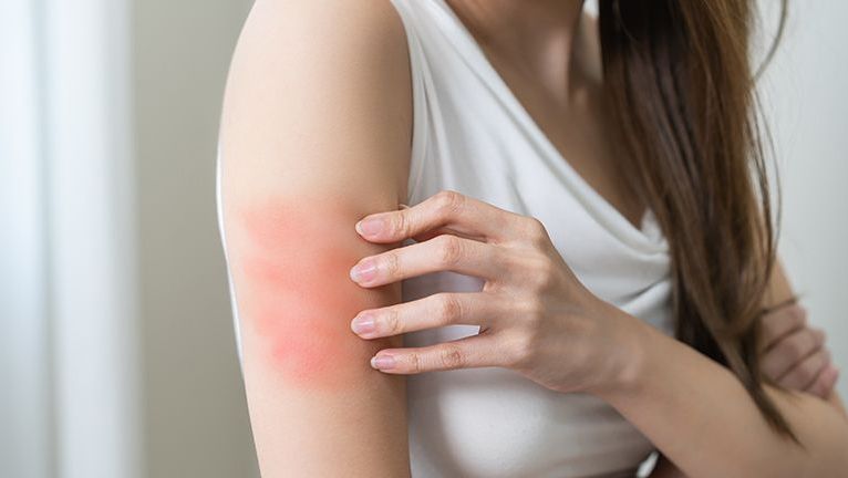 Pakiet badań - alergiczny atopowy (20 alergenów)