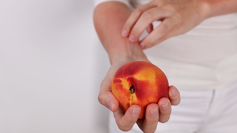 Pakiet badań - alergiczny owoce (10 alergenów)