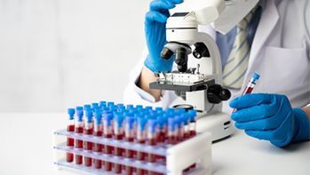 Serologia kiły (VDRL)