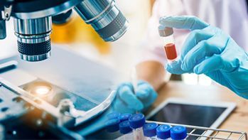 HCV Badanie przeciwciał