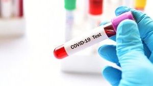 Przeciwciała po przechorowaniu SARS-CoV-2 całkowite ilościowo