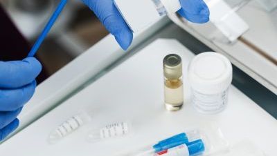 Cytologia LBC + HPV 28