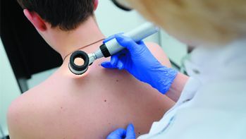 Skin marks under control – video dermatoscopy