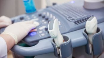 Cardiac echocardiogram with Doppler – adults