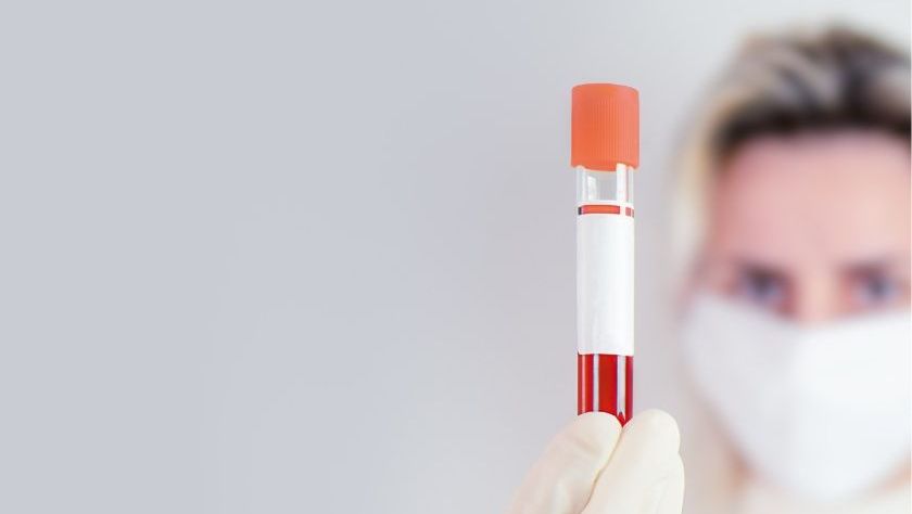 FibroTest, full test