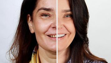 Metamorfoza uśmiechu - konsultacja