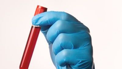 Żelazo na czczo - surowica